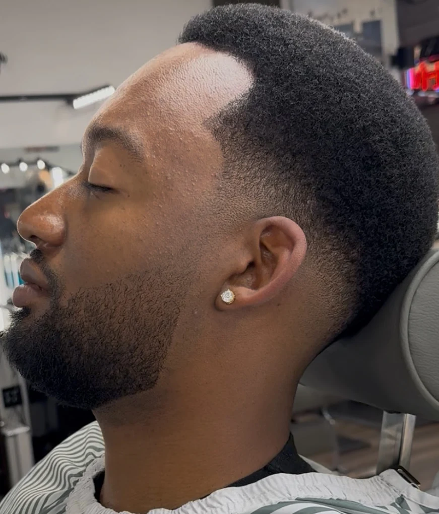 Temple fade with a sculpted beard line